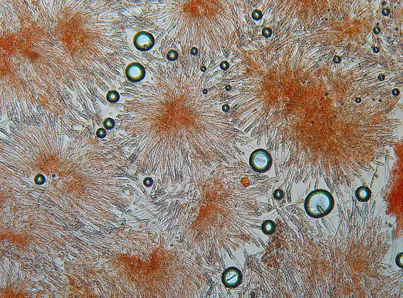 Bisporella citrina